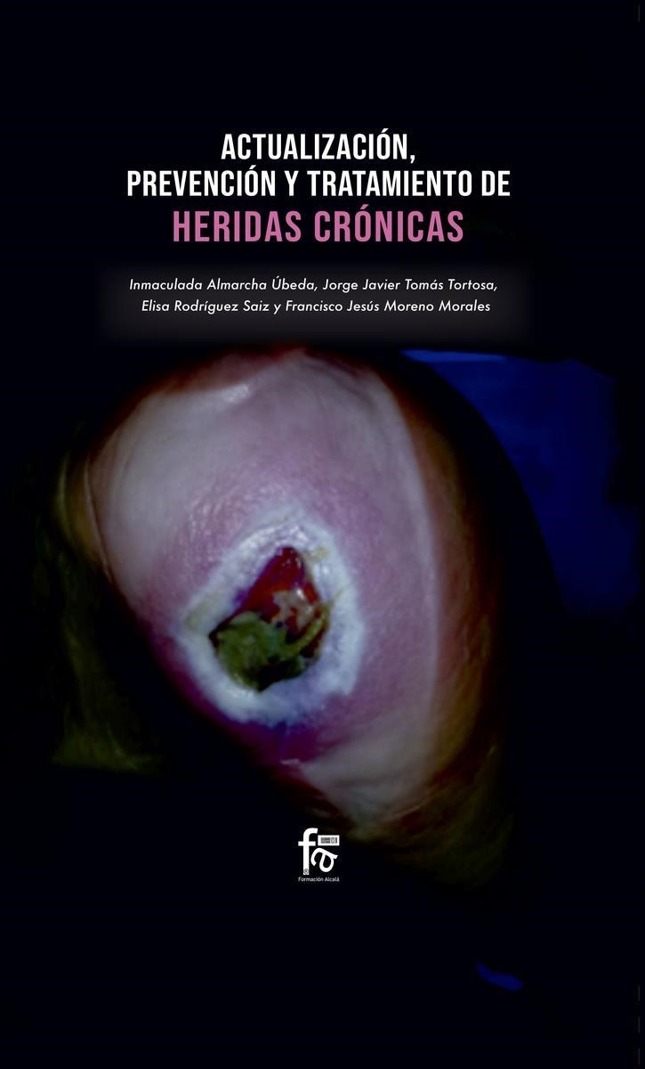 ACTUALIZACIÓN PREVENCIÓN Y TRATAMIENTO DE HERIDAS CRÓNICAS | 9788413239729 | MORENO & ALMARCHA